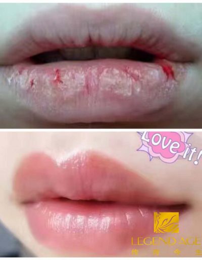 Legend Age lipstick repairs dry lips